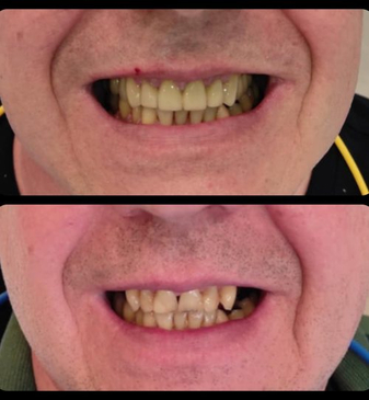 Slider image (9) Dr. Aleksandar Kovacevic - Dental Clinic in Croatia